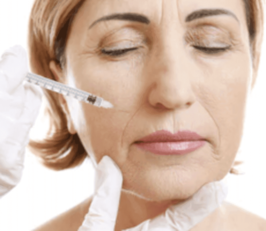 Fillers — treatment at Dr. Shawl's office