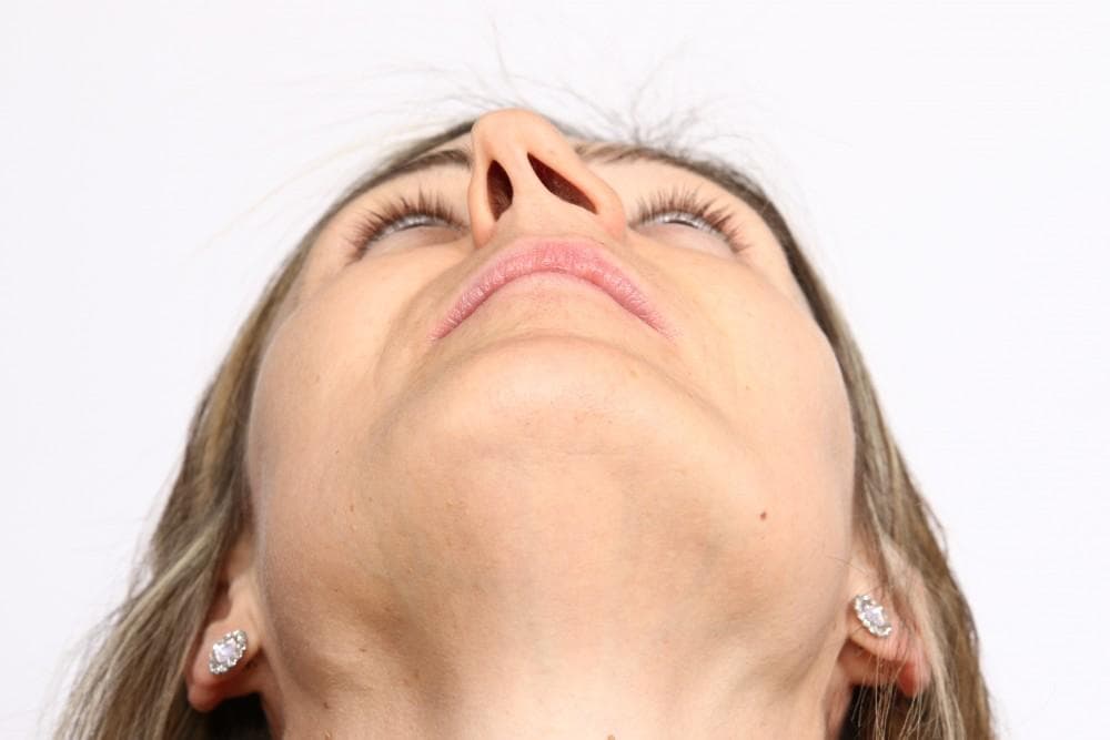 Breathing Through One Nostril? Why Your Septum Might Be to Blame